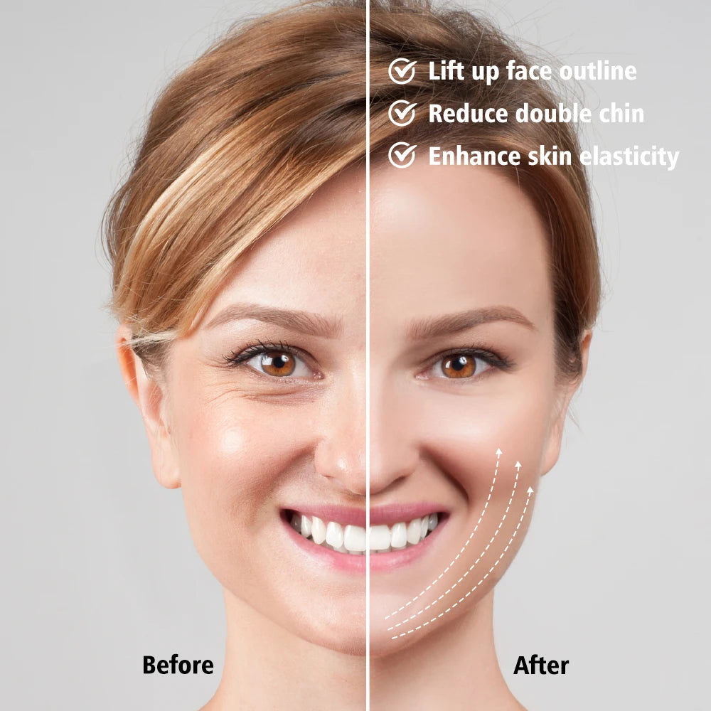 Reductor de Papada Lifting V-Face
